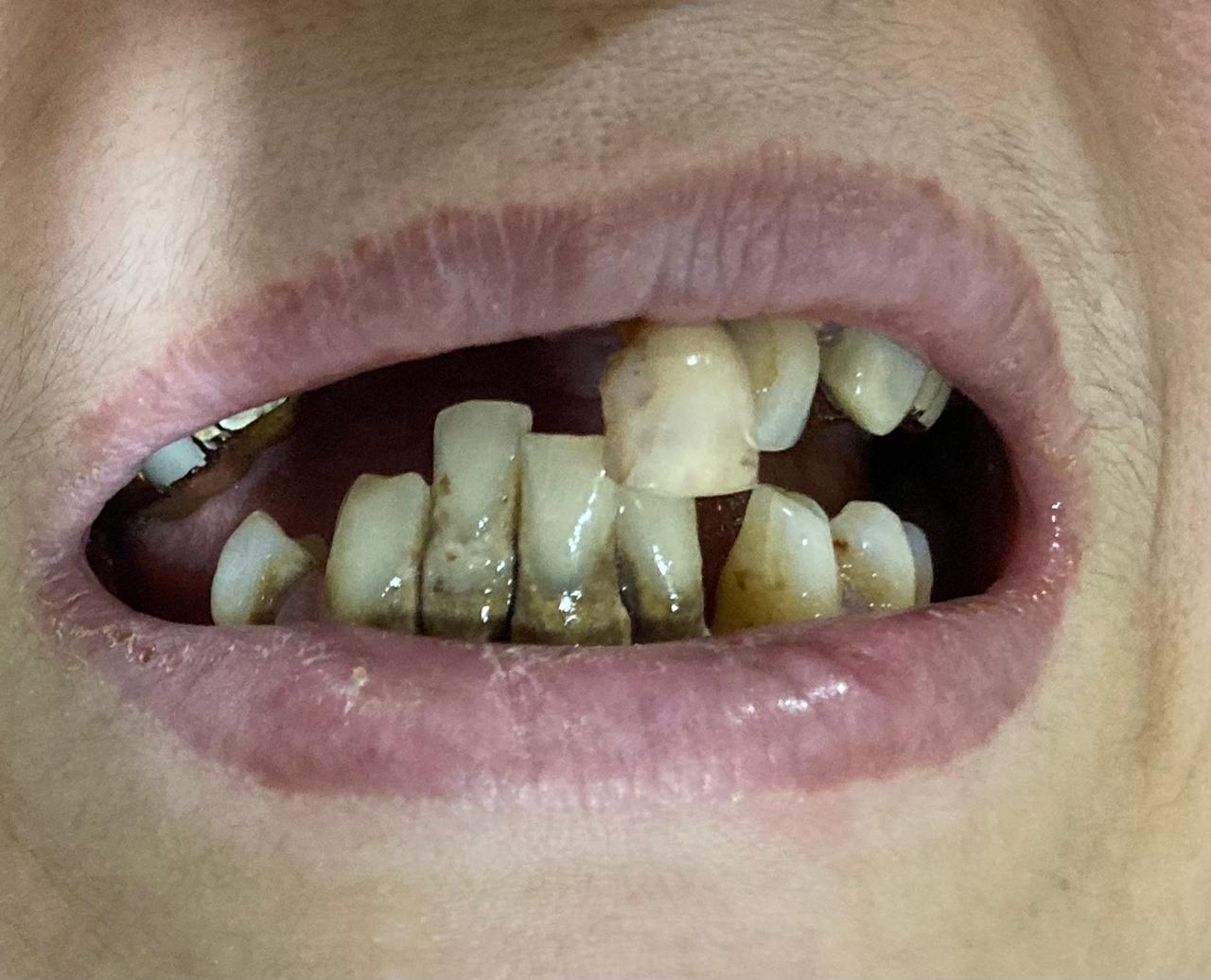 Gallery Orocare Dental Clinic in Bangalore Karnataka Cosmetic